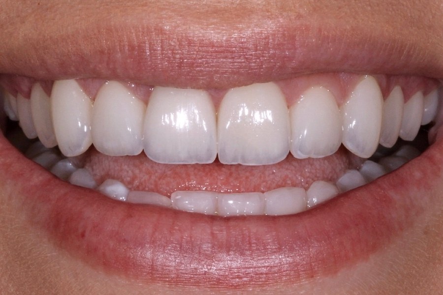 Sorriso antes do tratamento