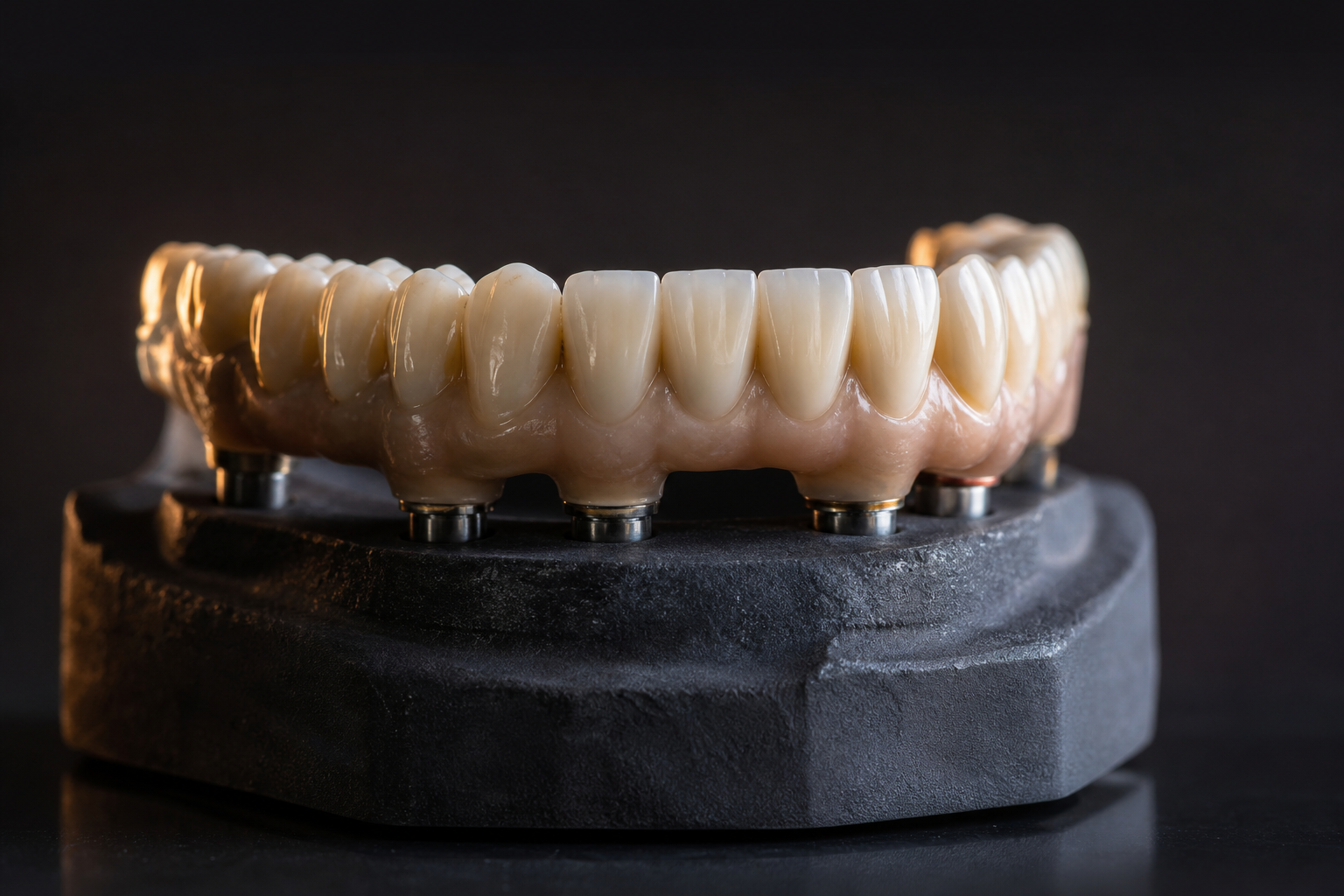 Reabilitação oral sobre implantes